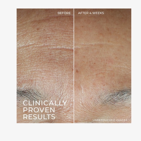 NIB!! ROC Hydration+ Serum - Picture 5 of 10